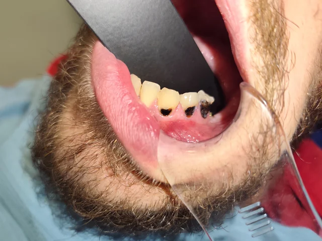 Primera fotografía de un caso dental, vista lateral · Clínica Dental Divina Pastora, Ansoáin